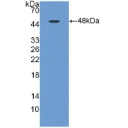 Microtubule-Associated Protein Tau (MAPT) Antibody