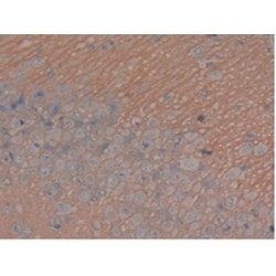 Microtubule-Associated Protein Tau (MAPT) Antibody
