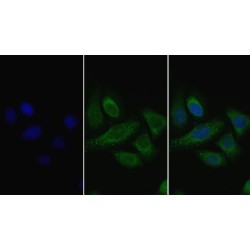 Lipoprotein Lipase (LPL) Antibody