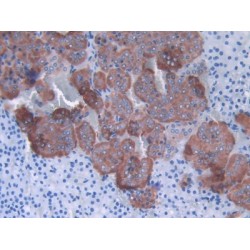 Sex Hormone Binding Globulin (SHBG) Antibody