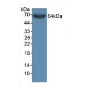 Western blot analysis of recombinant Rat PDCD1LG1/CD274 Protein (with N-terminal His and GST tags).