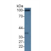 abx130341