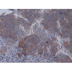 Signal Transducer And Activator of Transcription 2 (STAT2) Antibody