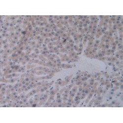 Signal Transducer And Activator of Transcription 2 (STAT2) Antibody