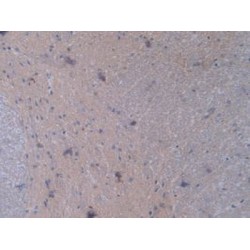 Signal Transducer And Activator of Transcription 2 (STAT2) Antibody