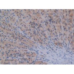 Signal Transducer And Activator of Transcription 2 (STAT2) Antibody