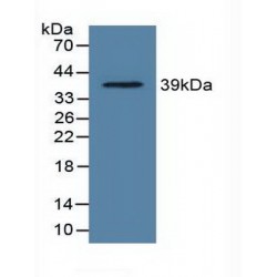 Lactate Dehydrogenase C (LDHC) Antibody