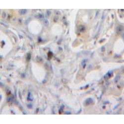 Regenerating Islet Derived Protein 3 Alpha (REG3a) Antibody