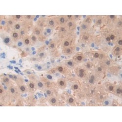 A Disintegrin And Metalloprotease 1 (ADAM1) Antibody