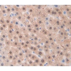 A Disintegrin And Metalloprotease 1 (ADAM1) Antibody