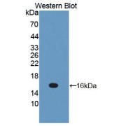 abx130383