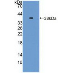 Nestin (NES) Antibody