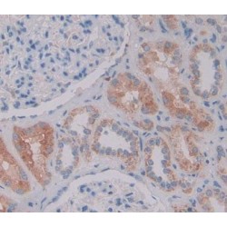 Nestin (NES) Antibody