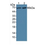 abx130388