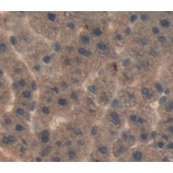 Lipopolysaccharide Binding Protein (LBP) Antibody