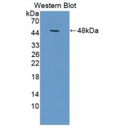 abx130389