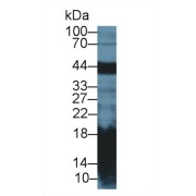 Western blot analysis of Mouse Pancreas lysate, using Rat REG1Aa Antibody (2 µg/ml) and HRP-conjugated Goat Anti-Rabbit antibody (<a href="https://www.abbexa.com/index.php?route=product/search&amp;search=abx400043" target="_blank">abx400043</a>, 0.2 µg/ml).