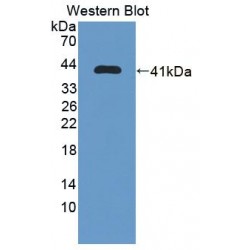 Iron Responsive Element Binding Protein 2 (IREB2) Antibody