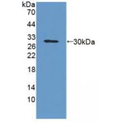 Glycoprotein A33 (GPA33) Antibody