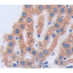 Uroporphyrinogen Decarboxylase (UROD) Antibody