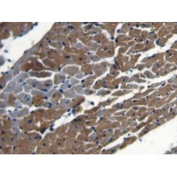 Nuclear Receptor Coactivator 3 (NCOA3) Antibody