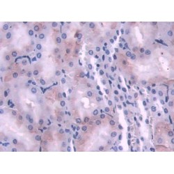 N-Myc Downstream Regulated Gene 2 (NDRG2) Antibody
