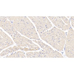 Interleukin-1 Beta (IL1B) Antibody