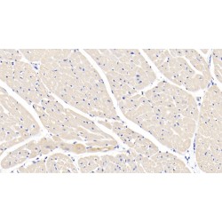 Interleukin 1 Beta (IL1b) Antibody