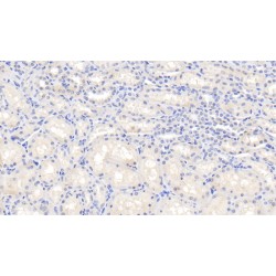 Interleukin-1 Beta (IL1B) Antibody