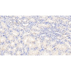 Interleukin 1 Beta (IL1b) Antibody