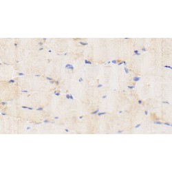 Interleukin-1 Beta (IL1B) Antibody
