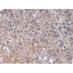 Heparan Sulfate 2-O-Sulfotransferase 1 (HS2ST1) Antibody