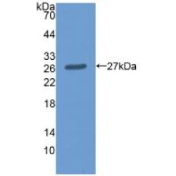 Malic Enzyme 2, NADP+ Dependent, Mitochondrial (ME2) Antibody