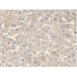 Malic Enzyme 2, NADP+ Dependent, Mitochondrial (ME2) Antibody