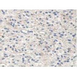 Malic Enzyme 2, NADP+ Dependent, Mitochondrial (ME2) Antibody
