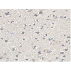 Malic Enzyme 2, NADP+ Dependent, Mitochondrial (ME2) Antibody