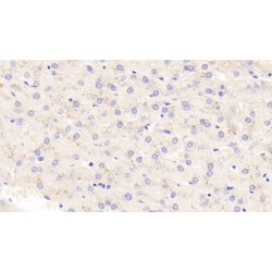 Thymic Stromal Lymphopoietin (TSLP) Antibody