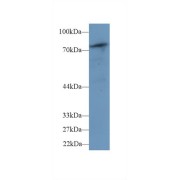 Western blot analysis of Mouse Skeletal muscle lysate, using Human PLCd4 Antibody (1 µg/ml) and HRP-conjugated Goat Anti-Rabbit antibody (<a href="https://www.abbexa.com/index.php?route=product/search&amp;search=abx400043" target="_blank">abx400043</a>, 0.2 µg/ml).