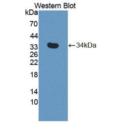 Phospholipase C Delta 4 (PLCd4) Antibody