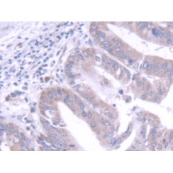 Fibroblast Growth Factor 20 (FGF20) Antibody