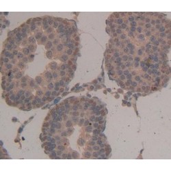 Nuclear Autoantigenic Sperm Protein, Histone Binding (NASP) Antibody