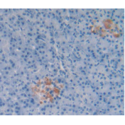 Substance P (TAC1) Antibody