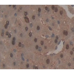 Phospholipase C Beta 3, Phosphoinositide Specific (PLCb3) Antibody