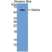 Western blot analysis of the recombinant protein.