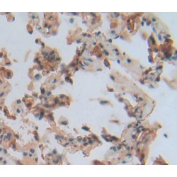 Regulator of G Protein Signaling 1 (RGS1) Antibody