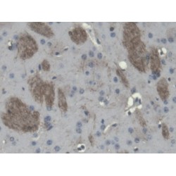 2, 3 Cyclic Nucleotide 3 Phosphohydrolase (CNP) Antibody