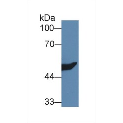 Hydroxymethylglutaryl-CoA Synthase, Mitochondrial (HMGCS2) Antibody