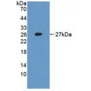 Western blot analysis of recombinant Human RPL23A.