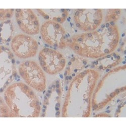 Ribosomal Protein L23A (RPL23A) Antibody