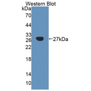 Western blot analysis of the recombinant protein.